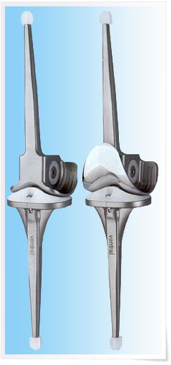 Шарнирный тотальный протез коленного сустава Endo-Model®
